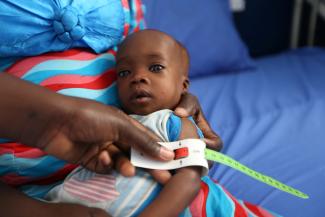 A child is screened for malnutrition, in Molai General Hospital, in Maiduguri, Nigeria, on November 30, 2016. 